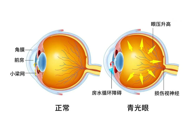 哈佛团队：干细胞可再生视网膜细胞，恢复视力长达1年！